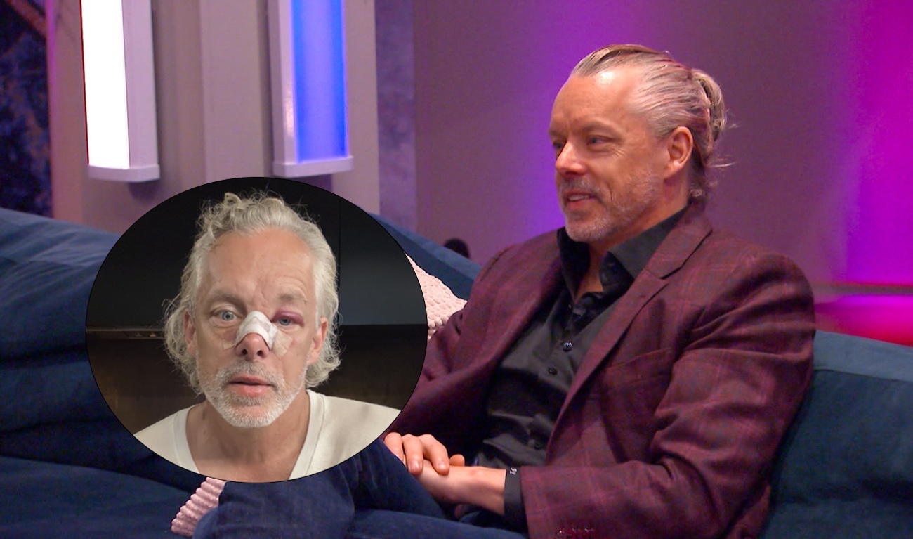 Image de l'article François Lambert apparaît le visage meurtri sur ses réseaux sociaux : il s'explique