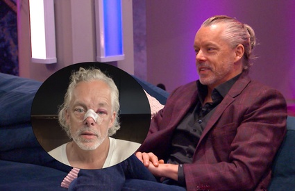 Image de l'article François Lambert apparaît le visage meurtri sur ses réseaux sociaux : il s'explique
