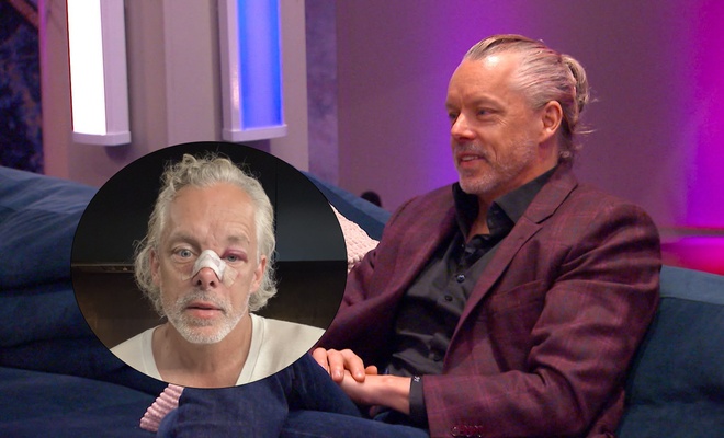 Image de l'article François Lambert apparaît le visage meurtri sur ses réseaux sociaux : il s'explique